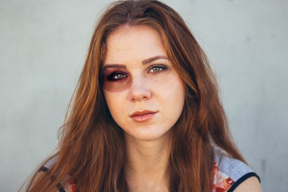 Photoshop bruise 2.jpg